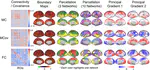 [OHBM 2024] Human Cerebral Cortex Organization Estimated by Functional PET-FDG Metabolic Connectivity