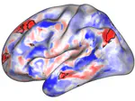 iGENMap: Data-Efficient Precision Functional Mapping
