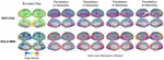 Human Cerebral Cortex Organization Characterized by Functional PET-FDG “Metabolic Connectivity”